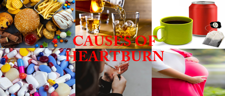 What causes heartburn